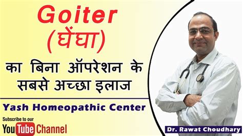 Goiter Treatment Without Operation घेंघा रोग का बिना ऑपरेशन के इलाज