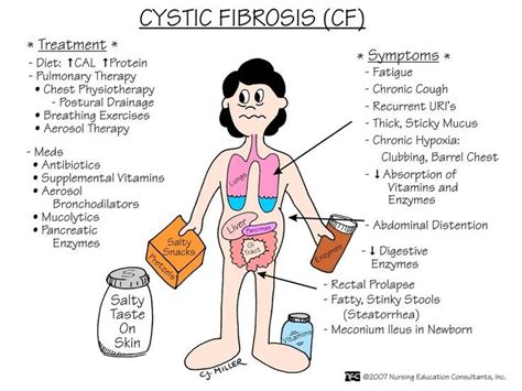 Cystic Fibrosis Nursing School Surgical Nursing Medical Surgical