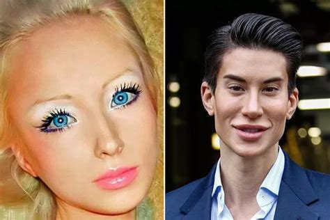 Weirdest Cosmetic Surgery From Real Life Ken Doll Rodrigo Alves To Vampire Facials Welcome