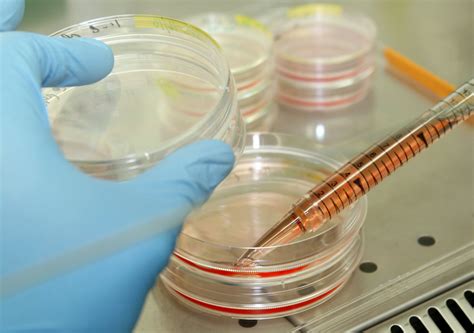 Stem Cell Research Will Save Lives And Congress Needs To Act Now Opinion