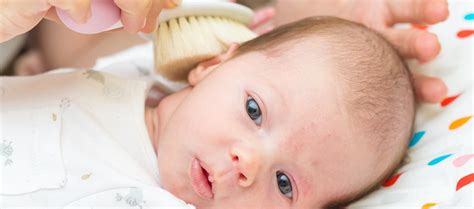 Dry Skin On Newborn Head See These Natural Remedies Diy Cosmetics