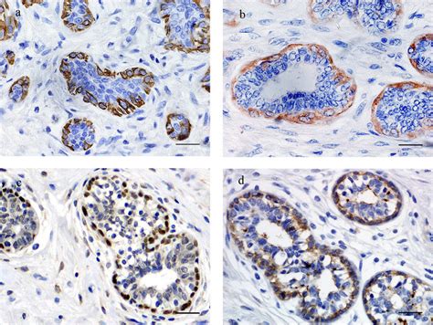 Immunohistochemical Expression Pattern Of Myoepithelial Cell Markers In