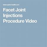 Spinal Facet Injection Side Effects Pictures
