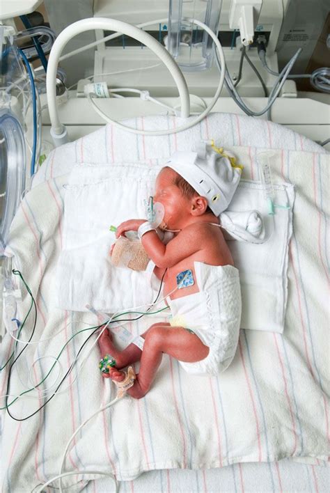 Photo Gallery Greater Hall Chamber Of Commerce Nicu Baby Neonatal