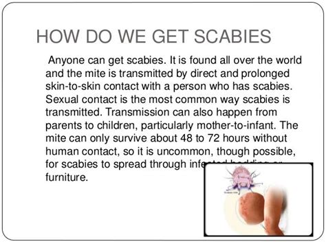 How To Do With Long Scabies Scabies Article