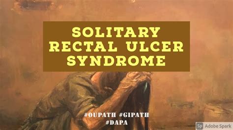 Solitary Rectal Ulcer Syndrome Youtube