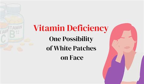 Vitamin Deficiency One Possibility Of White Patches On Face Biowellbeing