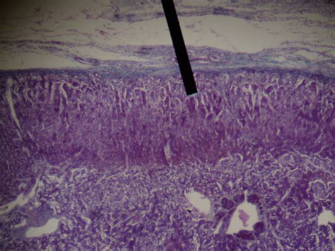 Zona glomerulosa - wikidoc