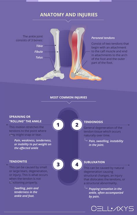 Peroneal Tendon Injuries And How To Treat Them Cellaxys
