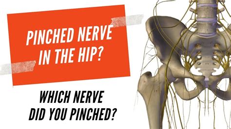 Physical Therapy Pinched Nerve In The Hip Youtube