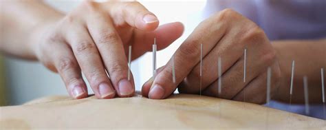 Family Based Acupuncture Clinic Brisbane | Acupuncturist in Brisbane