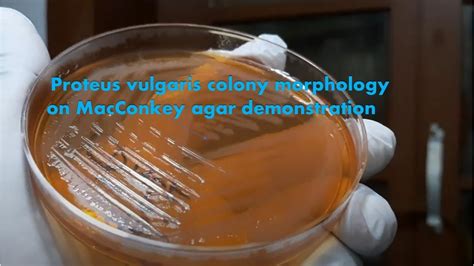 Proteus Vulgaris Colony Characteristics On Macconkey Agar Youtube