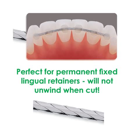 Jan 11, 2013 · answer: Braided Lingual Retainer Wire - Orthodontic Supply ...