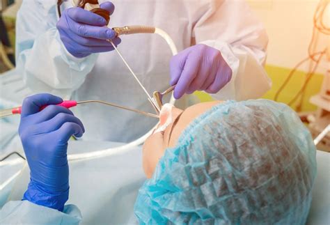 Minimally Invasive Surgery Options Septoplasty And Endoscopic Sinus