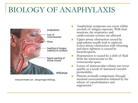 Ppt The Biology Of Anaphylaxis Powerpoint Presentation Free Download