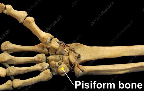 Pisiform Bone Stock Image C0432912 Science Photo Library