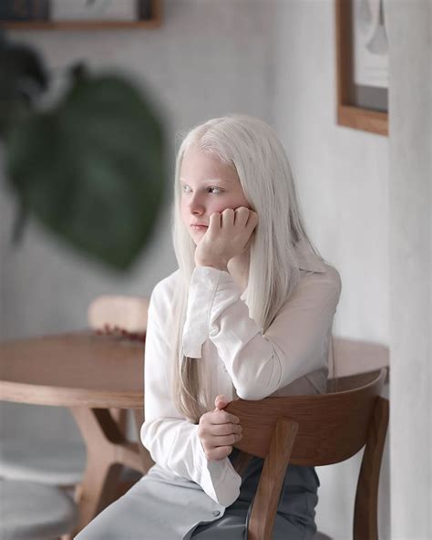 Photographer Captured The Ethereal Portraits Of Beautiful Girl With Albinism And Heterochromia