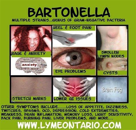 Moe Zijn Is Zooo Blog Maskers Af The Ugly Truth About Bartonella