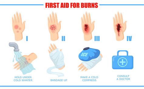 Ways Of Healing Different Skin Burn Injuries Stock Illustration