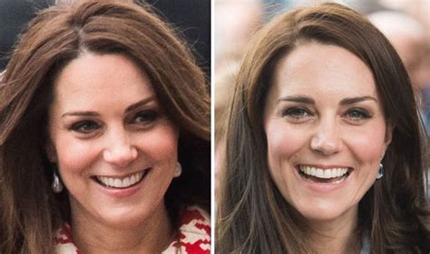 Kate Middleton News Duchess Of Cambridge Denies Using Botox Injection In Royal News Royal