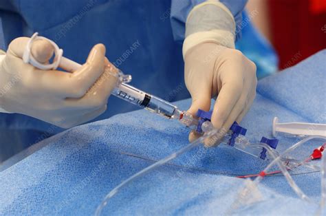 Administering Local Anesthetic Stock Image C0015409 Science Photo Library