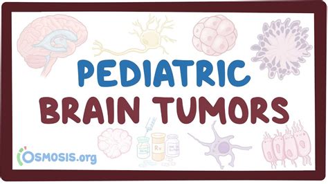 Pediatric Brain Tumors Causes Symptoms Diagnosis Treatment