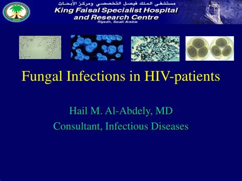 Ppt Fungal Infections In Hiv Patients Powerpoint Presentation Free