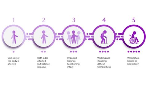 Exploring The 5 Stages Of Parkinsons Disease