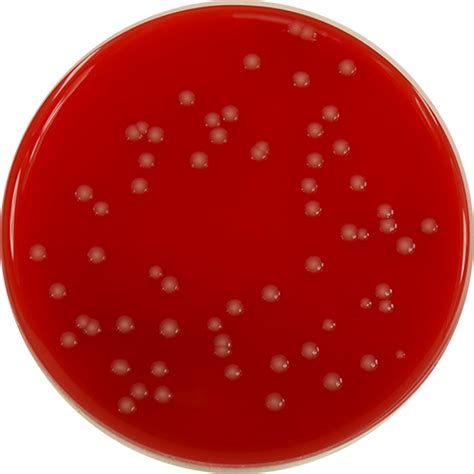 Pp1220 Blood Agar No2 With 7 Defibrinated Horse Blood E And O