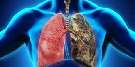 Occupational Lung Disease Webinars