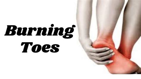 Burning Toes Syndrome Symptoms Causes Diagnosis And More
