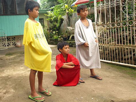 Doh Discourages Use Of Traditional De Pukpok Circumcisions Gma News Online