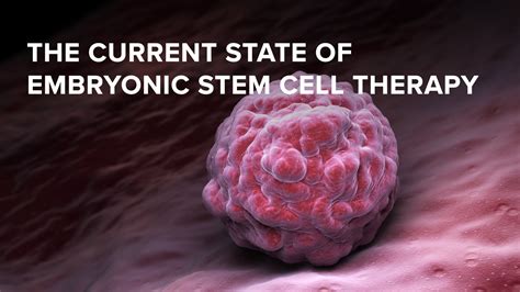 The Current State Of Embryonic Stem Cell Therapy Stemcell Arts