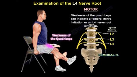 Examination Of L4 Nerve Root —