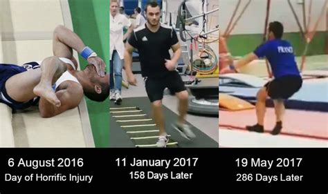 Samir ait said, a french artistic gymnast, suffered a severe leg injury at rio 2016. Remember Samir Ait Said who suffered horrific leg injury ...