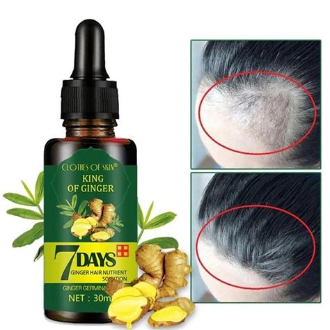 Over 48,000 clients worldwide are experiencing complete restoration from hair loss from medication. Hair ReGrowth Serum® - Alma Select in 2020 | Essential ...