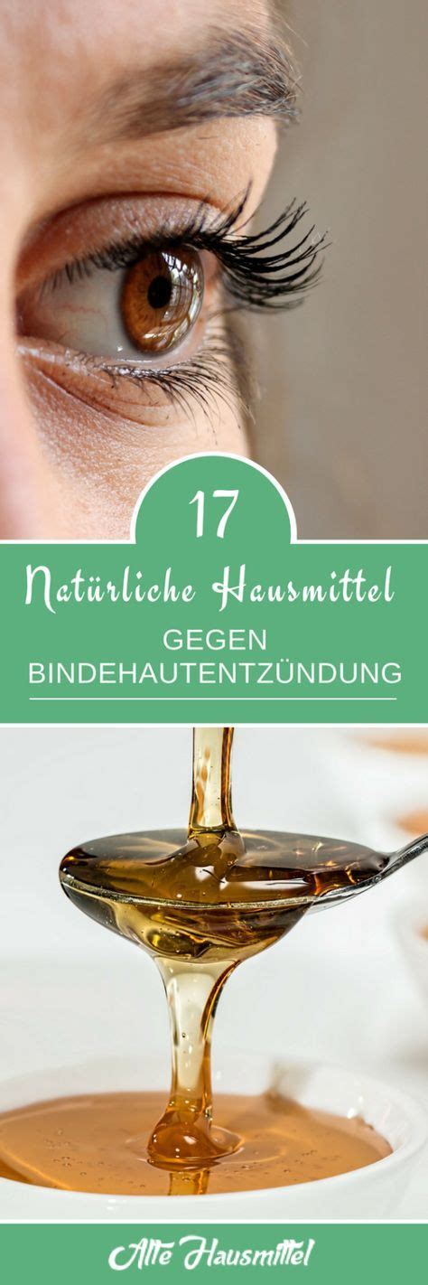 17 natürliche Hausmittel gegen Bindehautentzündung Hausmittel