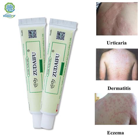 Psoriasis Cream Herbal Ointment Chinese Traditional Plaster 1pcs