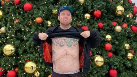 New Found Glorys Chad Gilbert Announces Hes Cancer Free