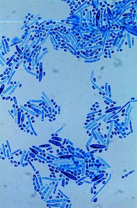 Trichosporon Fungi Print Inspiration Text On Photo Microbiology