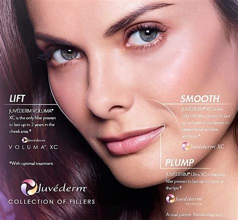 JuvÉderm® Fillers Body Contouring Doucet Medical Spa Botox Cosmetic