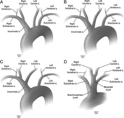 Figure Bovine Arch And Other Aortic Arch Variations