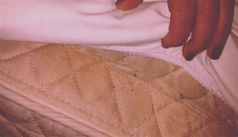 Bed bugs as a pest. Sue a Marriott Hotel For Bed Bug Bites | Find Hotel Bed ...