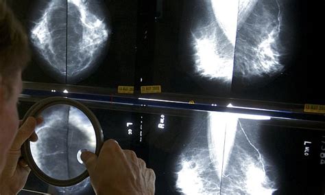 Doctors Will Have To Tell Women How Dense Their Breasts Are At Routine