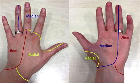 A Painful Tingling Hand The Bmj