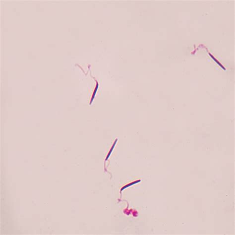 Frog Sperm Smear Microscope Slide