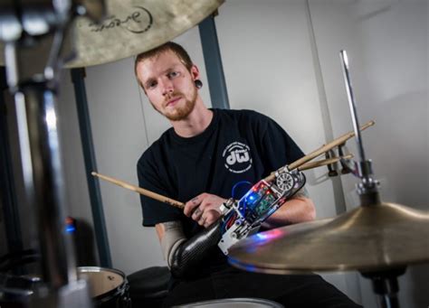 Robotic Drumming Prosthesis Could Help Make Music And More X8 Drums