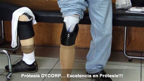 Prótesis Para Pacientes Amputados Transtibiales O Abajo De Rodilla