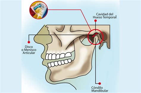 tensión en la mandíbula causas efectos y ejercicios de relajación clínica vass