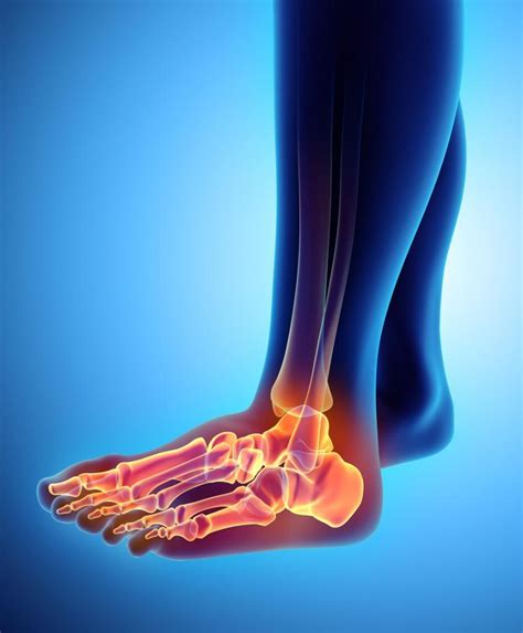 Ankle Sprains Jacksonville Orthopaedic Institute